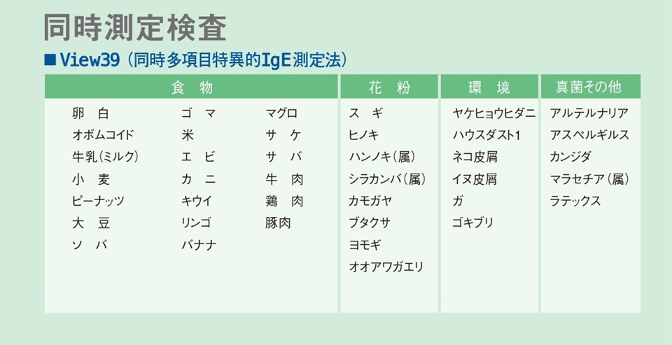VIEW-39