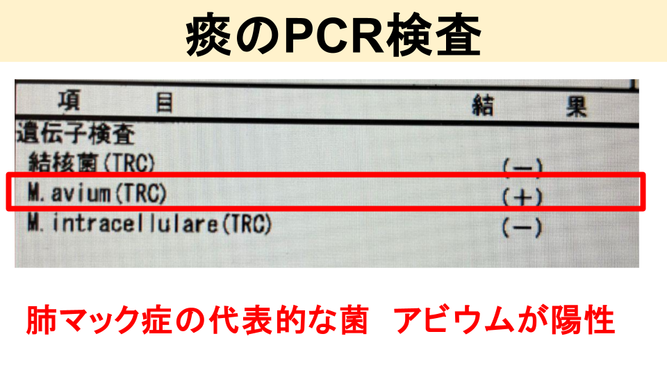 喀痰検査（かくたんけんさ）