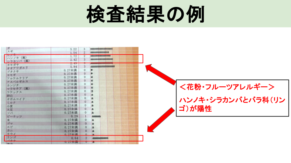 血液検査（特異的IgE測定）