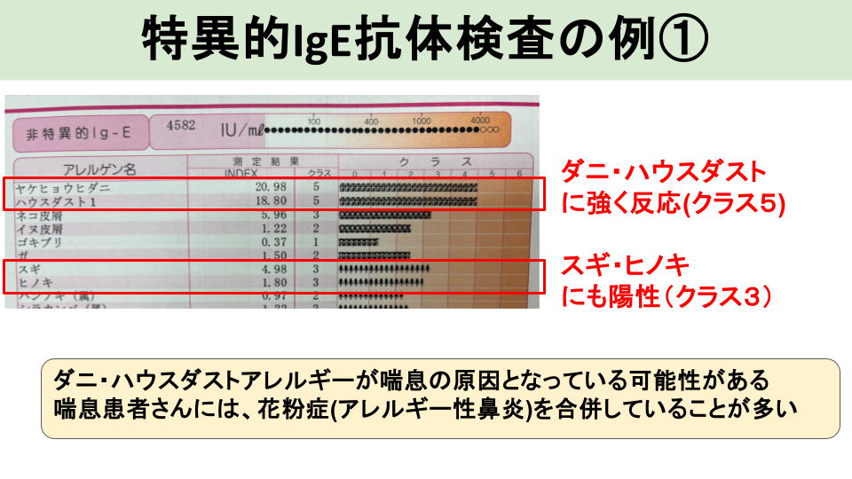 特異的IgE抗体検査