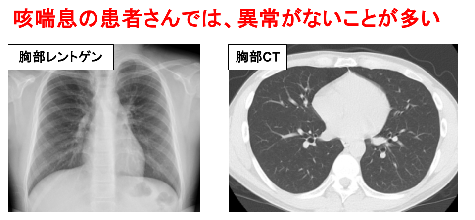 2. 胸部レントゲン・CT