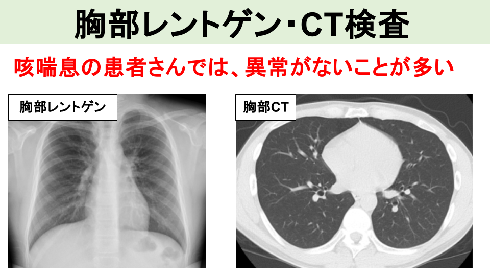 2. 胸部レントゲン・CT
