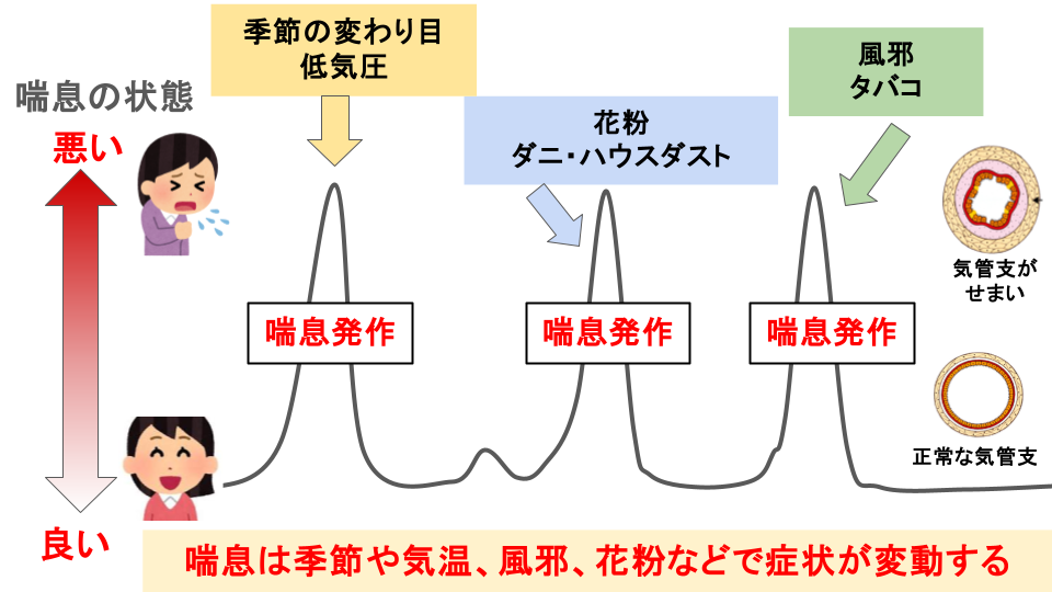 喘息の原因と症状（喘息ってどんな病気？）