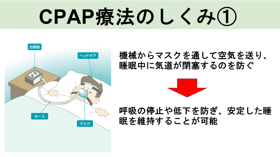 CPAP療法のしくみ