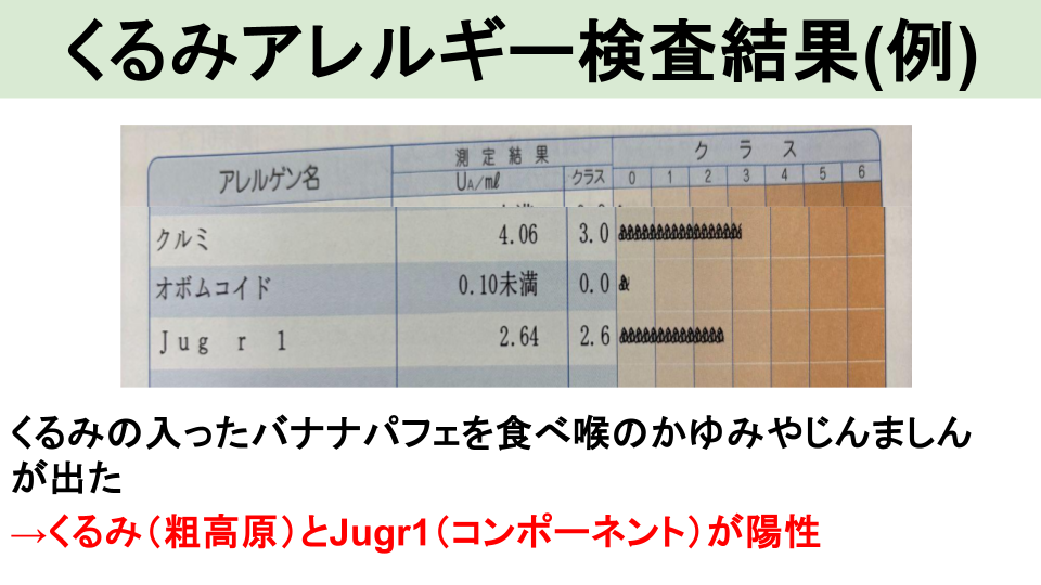 ナッツ類