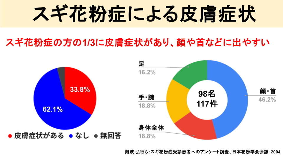 スギ花粉症で皮膚が赤くなったりするの？