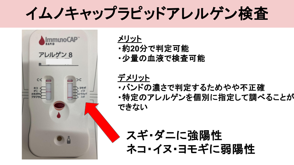 イムノキャップラピッドアレルゲン検査