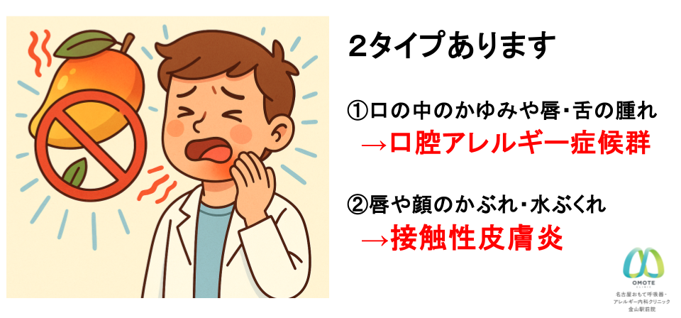 マンゴーアレルギー
