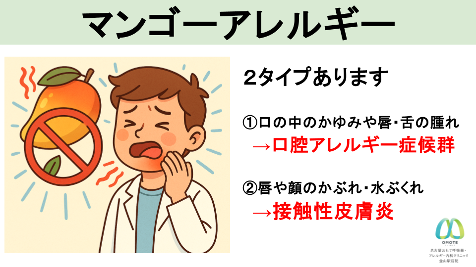 マンゴーアレルギー