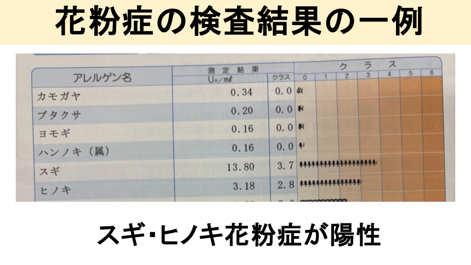 花粉症の検査