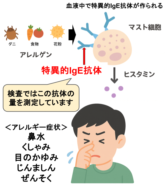 特異的IgE抗体検査ってなに？