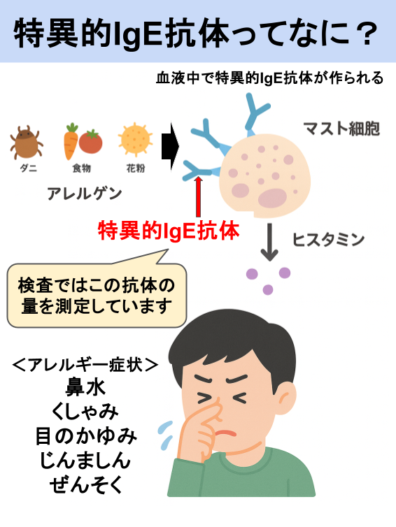 特異的IgE抗体検査ってなに？