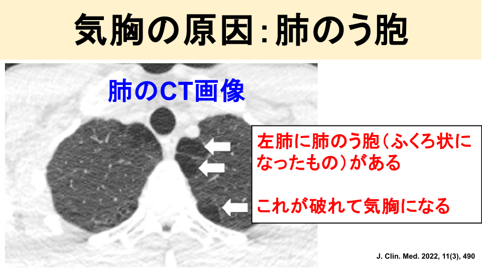 検査・診断方法