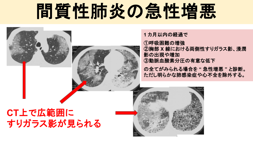 どんな症状に注意？