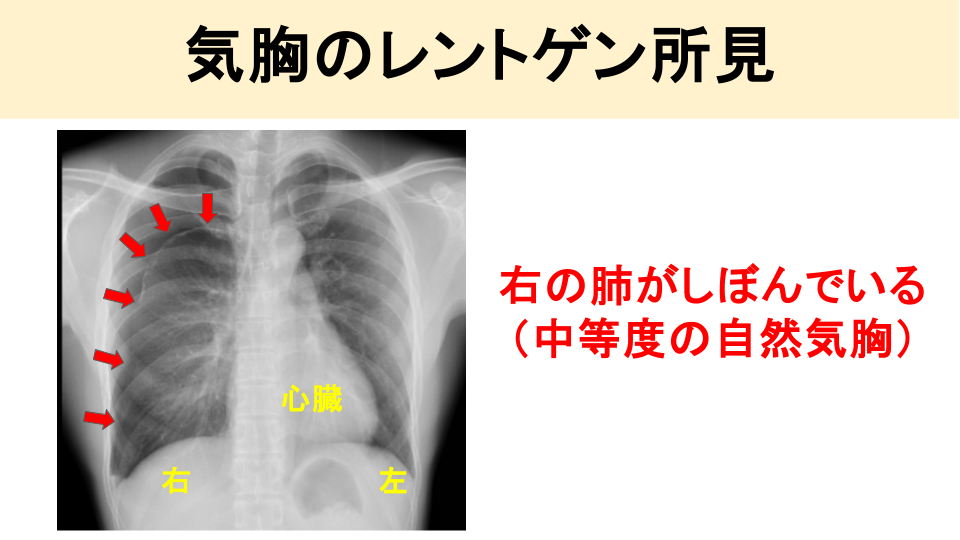 検査・診断方法