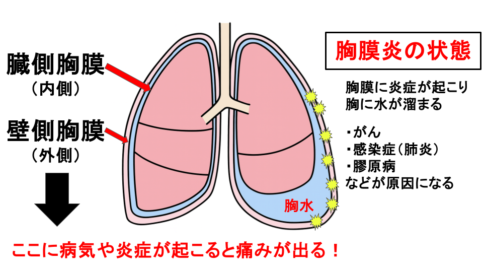 なぜ胸の痛みは起こる？