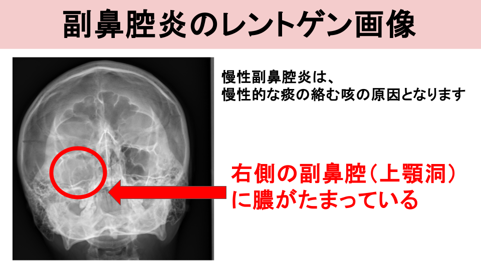 レントゲン検査（X線検査）