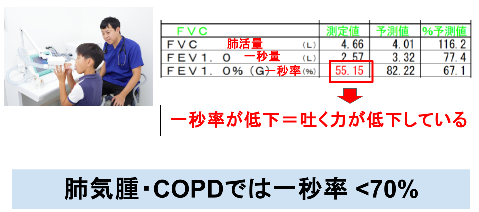 肺機能検査(スパイロメトリー)