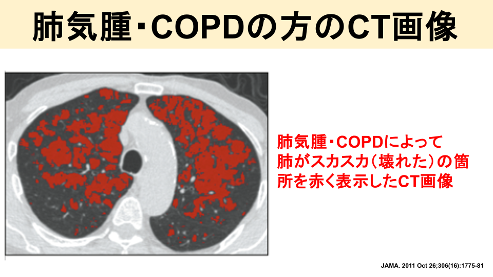 胸部レントゲン検査・胸部CT検査