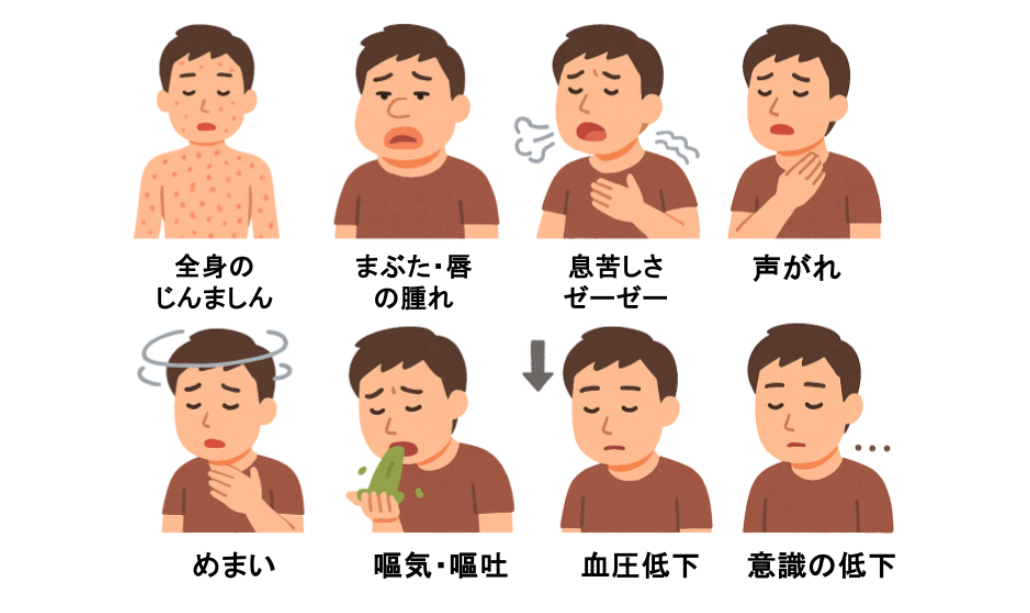 アナフィラキシーの症状