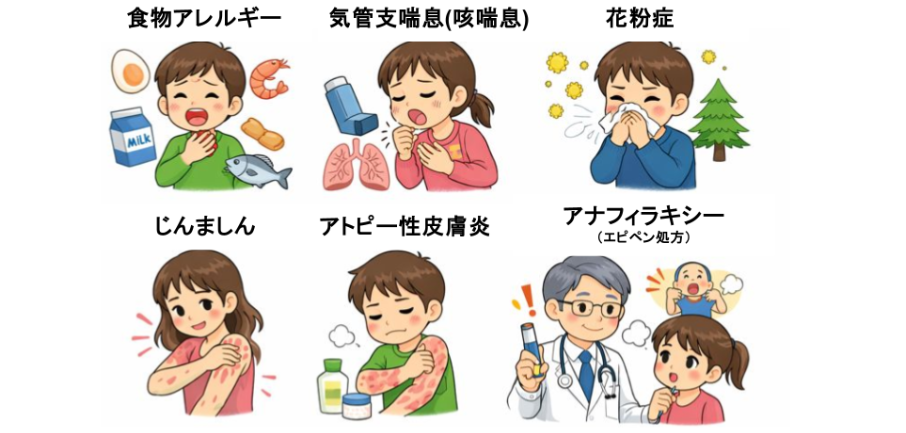 当院で行っているアレルギー診療