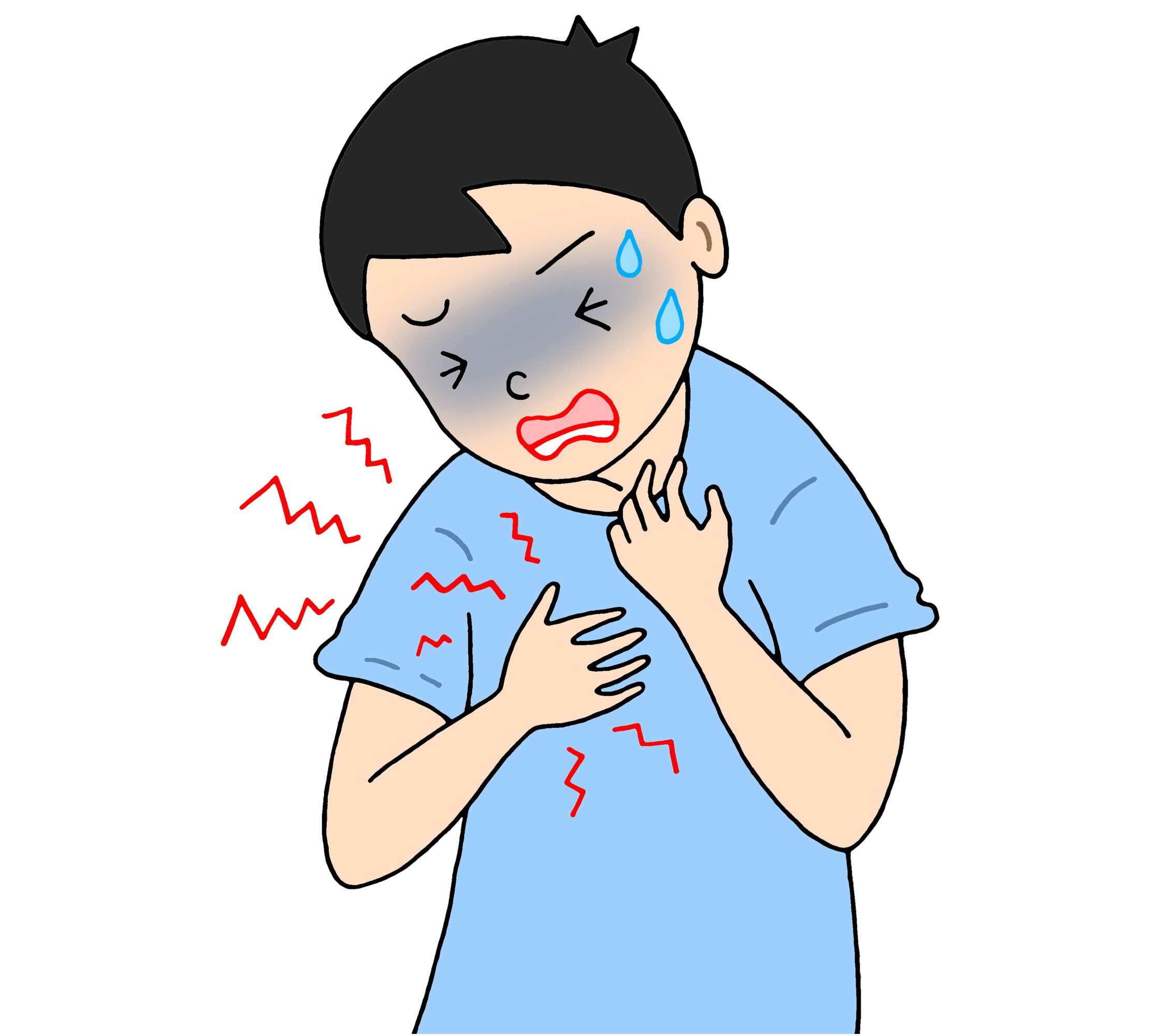 アナフィラキシー（エピペン）