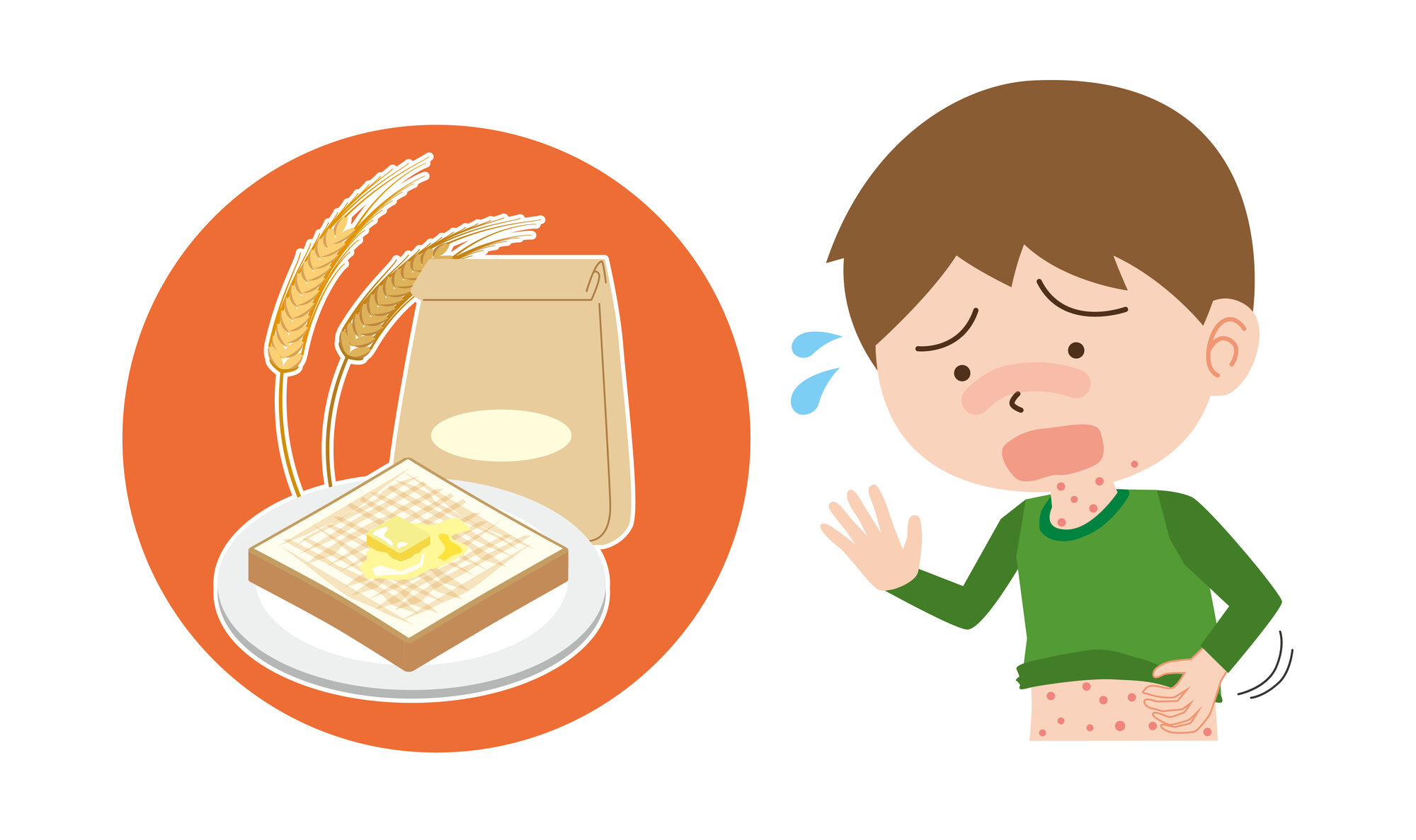 食物アレルギー