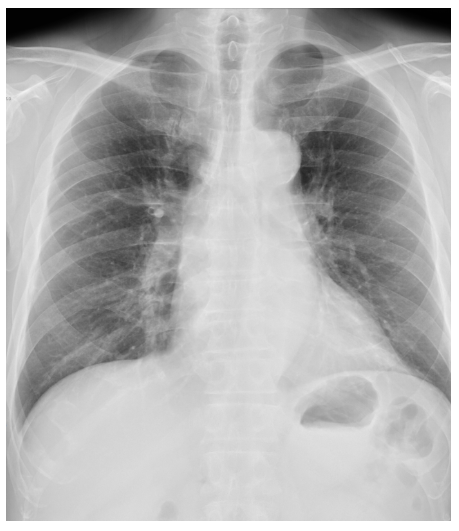 レントゲン検査・CT
